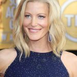 Anna Gunn plastic surgery (3)