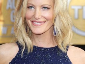 Anna Gunn plastic surgery (3)