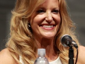 Anna Gunn plastic surgery (38)