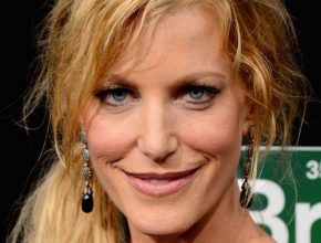 Anna Gunn plastic surgery (39)