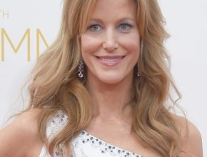 Anna Gunn plastic surgery (43)