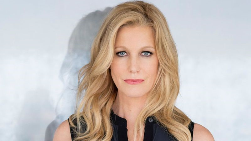 Anna Gunn plastic surgery