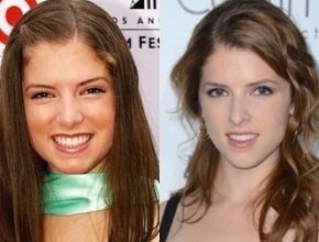 Anna Kendrick before and after plastic surgery (28)