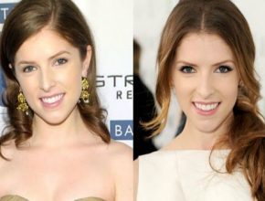 Anna Kendrick before and after plastic surgery (35)