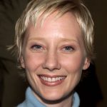 Anne Heche plastic surgery (1)