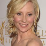 Anne Heche plastic surgery (11)