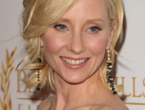 Anne Heche plastic surgery (11)