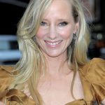 Anne Heche plastic surgery (12)