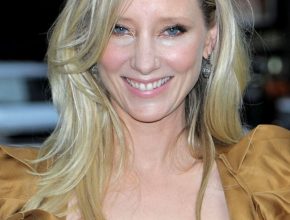 Anne Heche plastic surgery (12)
