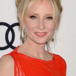 Anne Heche plastic surgery (20)