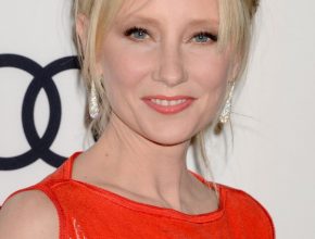 Anne Heche plastic surgery (20)