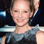 Anne Heche plastic surgery (21)