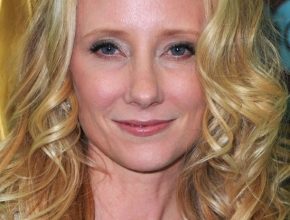 Anne Heche plastic surgery