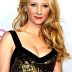 Anne Heche plastic surgery (26)