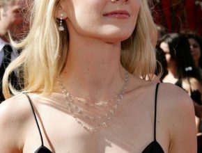 Anne Heche plastic surgery (27)