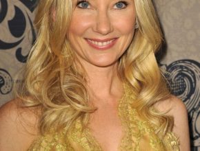 Anne Heche plastic surgery (28)