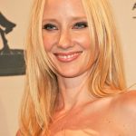 Anne Heche plastic surgery (3)
