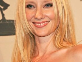 Anne Heche plastic surgery (3)