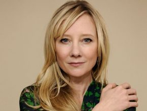 Anne Heche plastic surgery