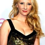 Anne Heche plastic surgery (34)