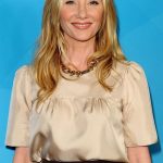 Anne Heche plastic surgery (9)