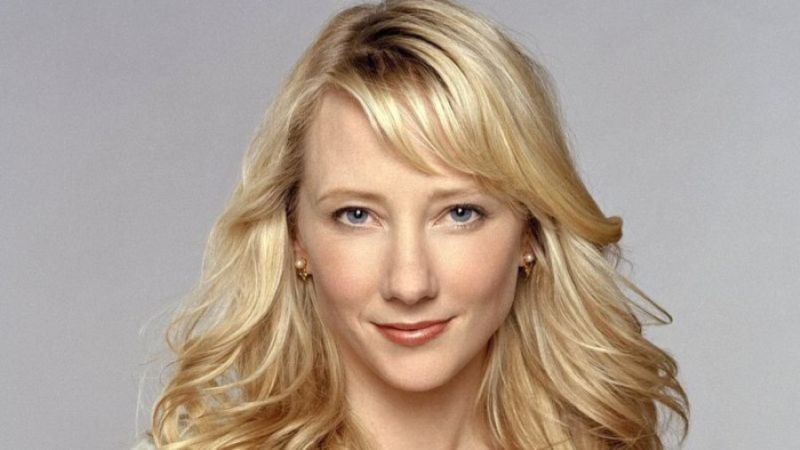 Anne Heche plastic surgery