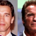 Arnold Schwarzenegger before and after plastic surgery (17)