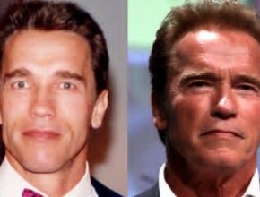 Arnold Schwarzenegger before and after plastic surgery (17)