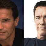 Arnold Schwarzenegger before and after plastic surgery (21)