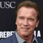 Arnold Schwarzenegger plastic surgery (1)