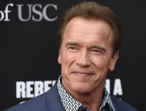 Arnold Schwarzenegger plastic surgery (1)