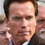 Arnold Schwarzenegger plastic surgery (10)