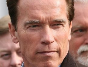 Arnold Schwarzenegger plastic surgery (10)