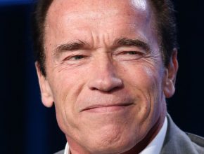 Arnold Schwarzenegger plastic surgery (11)