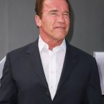 Arnold Schwarzenegger plastic surgery (13)