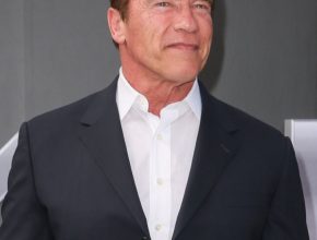 Arnold Schwarzenegger plastic surgery (13)