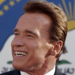 Arnold Schwarzenegger plastic surgery (14)