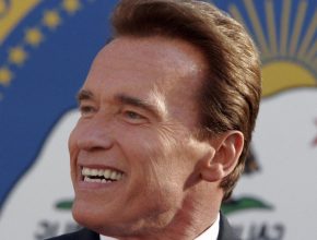 Arnold Schwarzenegger plastic surgery (14)