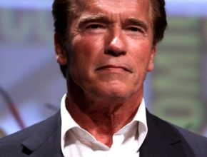 Arnold Schwarzenegger plastic surgery (2)