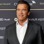 Arnold Schwarzenegger plastic surgery (22)