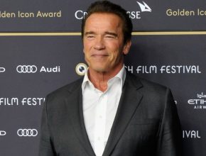 Arnold Schwarzenegger plastic surgery (22)
