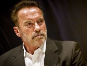 Arnold Schwarzenegger plastic surgery (23)