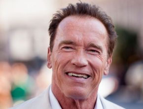 Arnold Schwarzenegger plastic surgery (24)