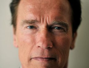 Arnold Schwarzenegger plastic surgery (25)