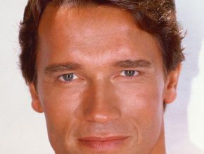 Arnold Schwarzenegger plastic surgery (26)