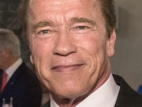 Arnold Schwarzenegger plastic surgery (3)