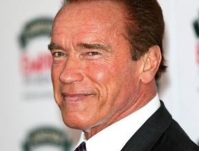 Arnold Schwarzenegger plastic surgery (33)