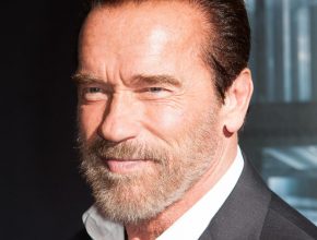 Arnold Schwarzenegger plastic surgery