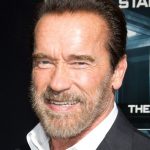 Arnold Schwarzenegger plastic surgery (39)