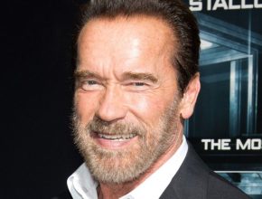 Arnold Schwarzenegger plastic surgery (39)